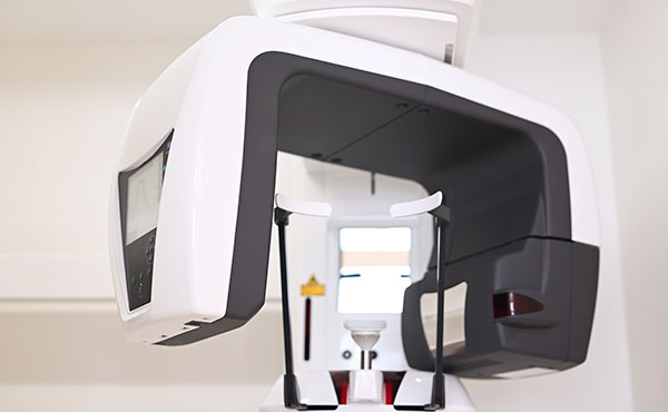 3Dスキャナー・CT等によるデジタル歯科医療